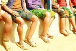 फागुन ११ गतेबाट हात्तीपाइले बिरुद्धको औषधी दिइने