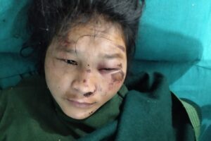 अस्पतालबाट आकृती लामा भागिन