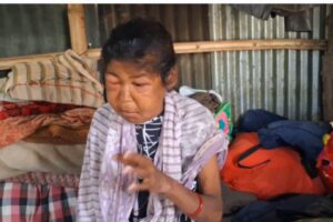 पैसा नहुँदा २० दिन देखी मिर्गौला रोगीले औषधी खान पाएनन्